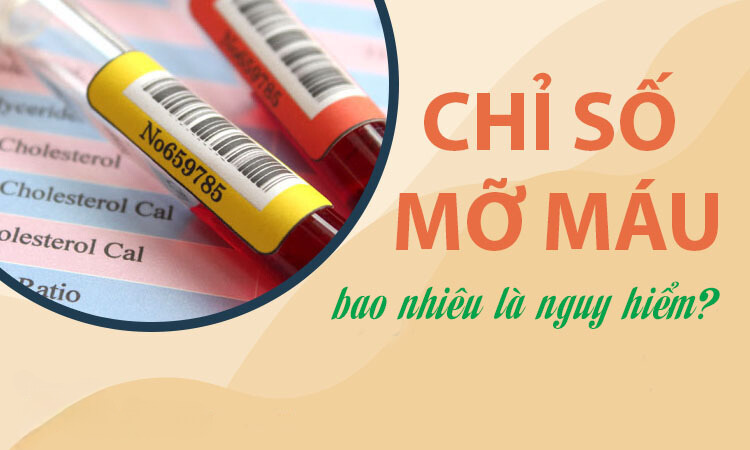 Chỉ số mỡ máu bao nhiêu là nguy hiểm và cách kiểm soát hiệu quả